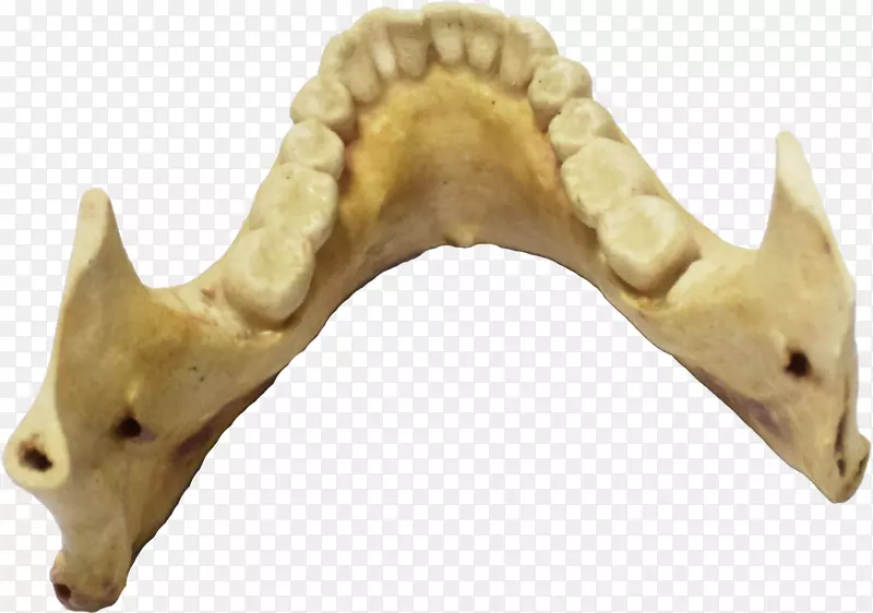 口鼻区系食肉-3D打印下颌骨