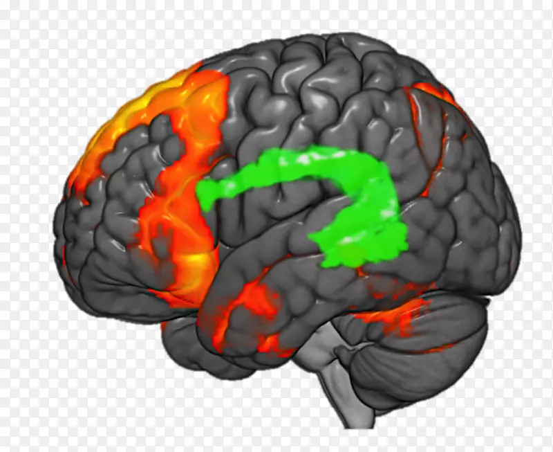 脑功能磁共振成像癫痫神经影像学