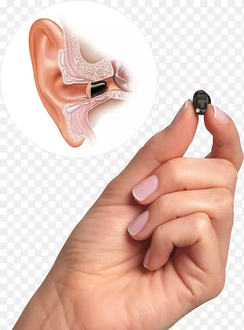 初级听力学助听器-耳部