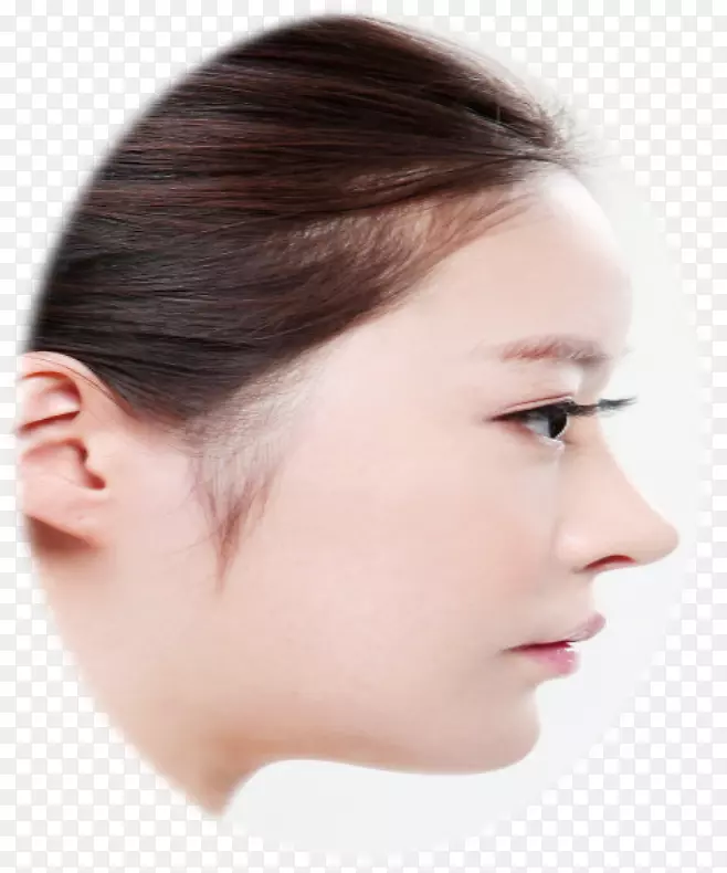 眉鼻桥鼻成形术-亚洲医生