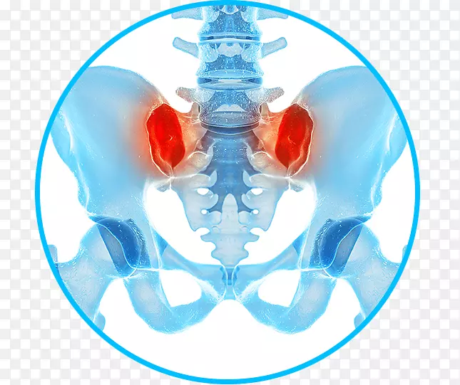 骶髂关节功能障碍疼痛在脊柱疼痛治疗骨盆关节疼痛中的应用