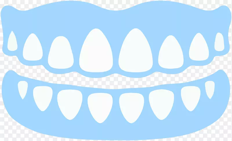 牙科种植体可摘局部义齿