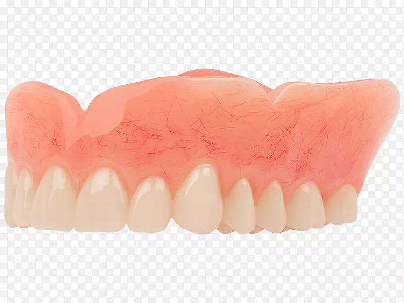 牙科义齿