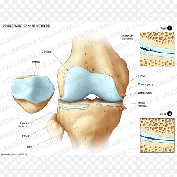 人体解剖膝关节人体胫骨