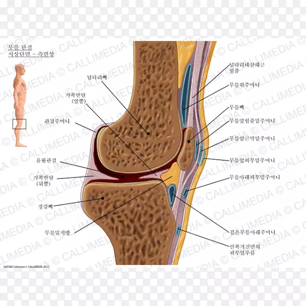 髌骨前滑膜囊髌骨下滑囊炎膝关节大疱