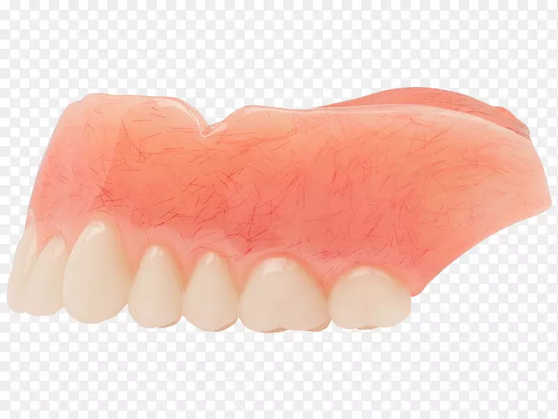人类牙齿义齿.经典遮阳