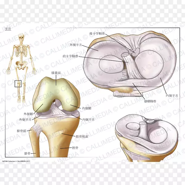 半月板膝关节撕裂骨关节炎膝関節-半月板