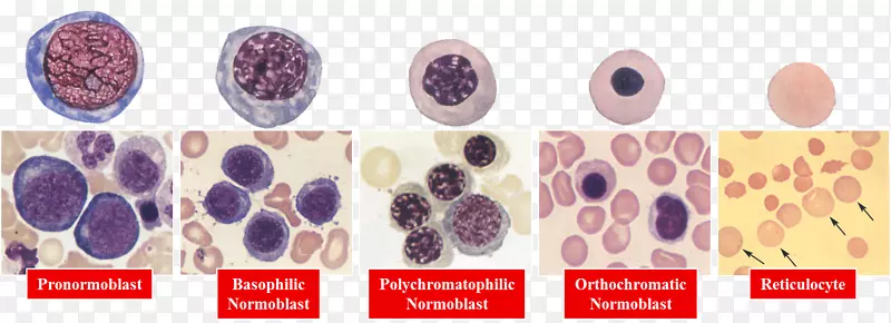 红细胞造血学中性粒细胞造血-多发性骨髓瘤