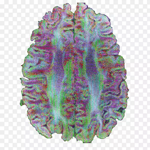 脑紫药-脑