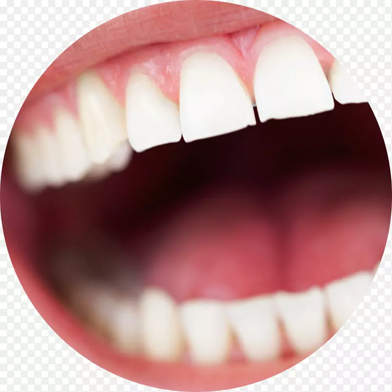 人牙种植体牙本质学-牙齿外科