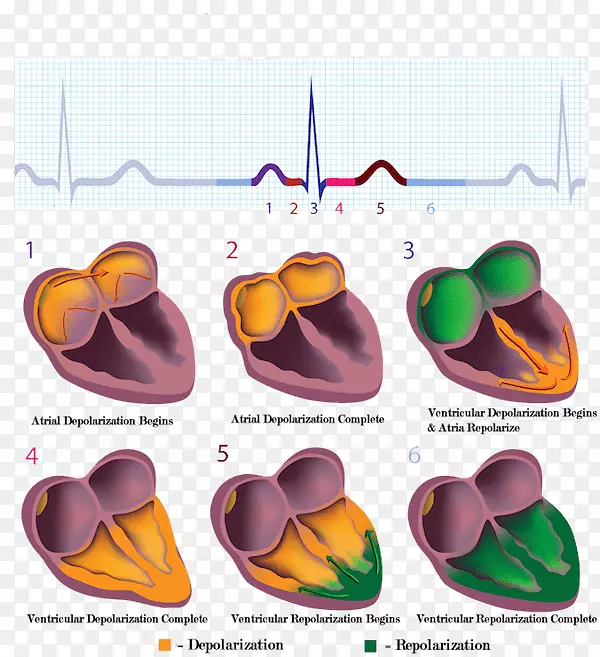 心脏血管摄影术的心肌心电图电导系统.心脏