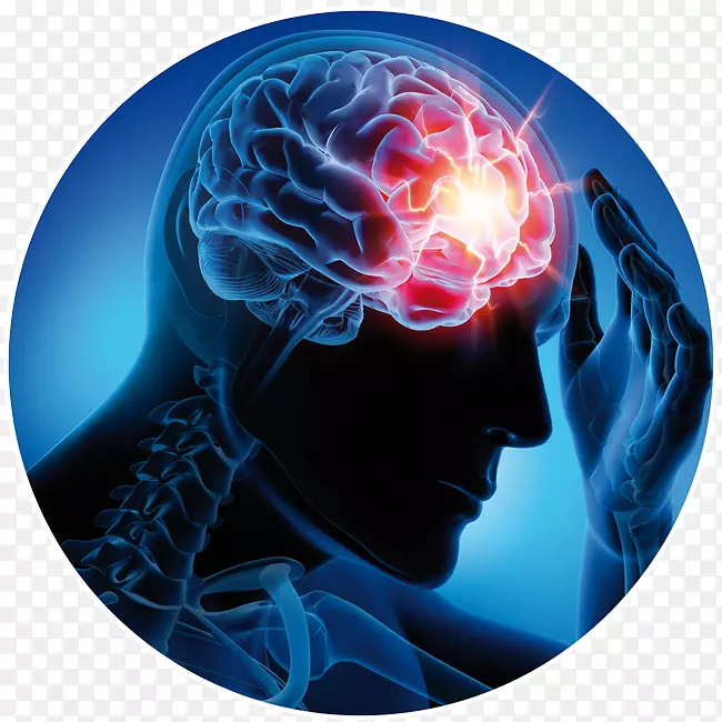 神经病学，癫痫，神经康复，癫痫发作-头部损伤
