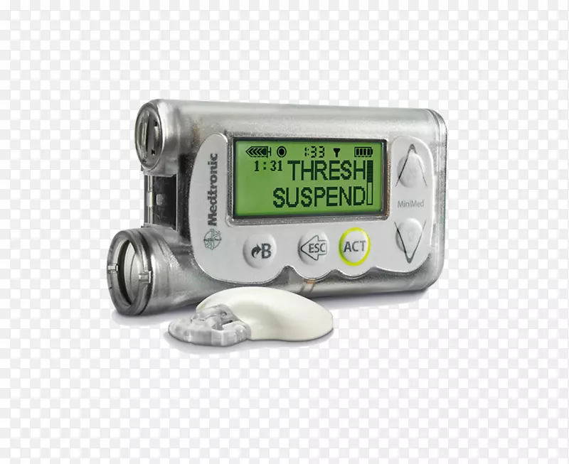胰岛素泵持续血糖监测仪