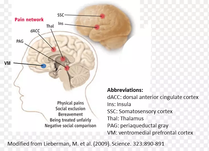 脑扣带回前扣带回大脑皮质腹侧被盖区-脑