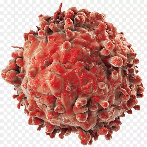 癌细胞急性髓系白血病淋巴细胞标志