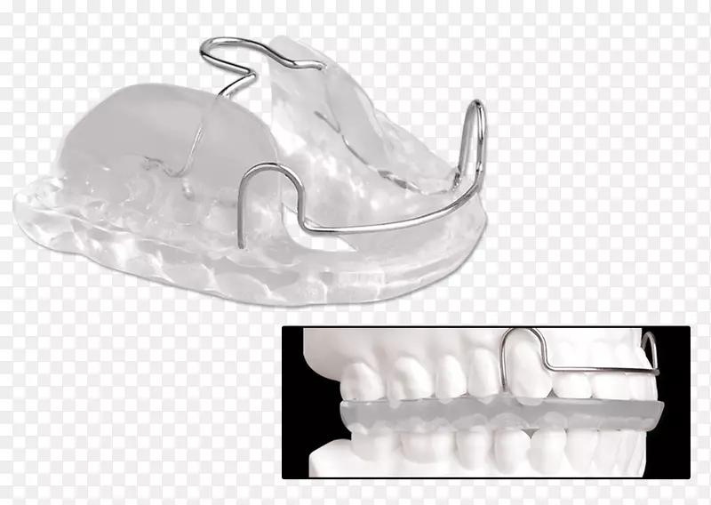 颌骨下颌夹板牙科上颌骨推进夹板