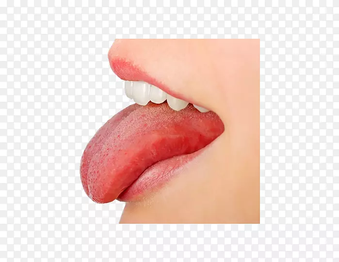刮舌器png图片溃疡病病理学-htc