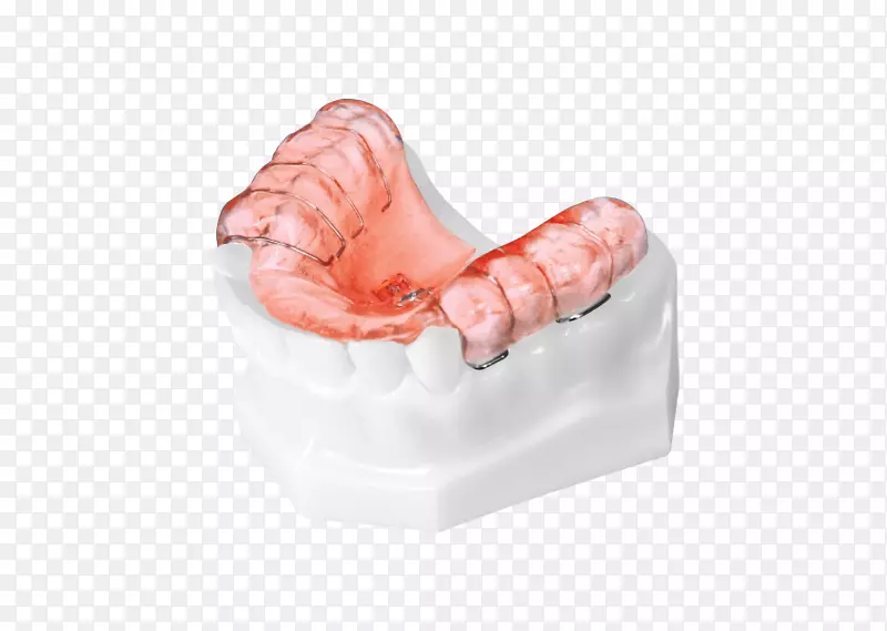 牙齿正畸家庭用具正畸技术产品设计正畸矫正