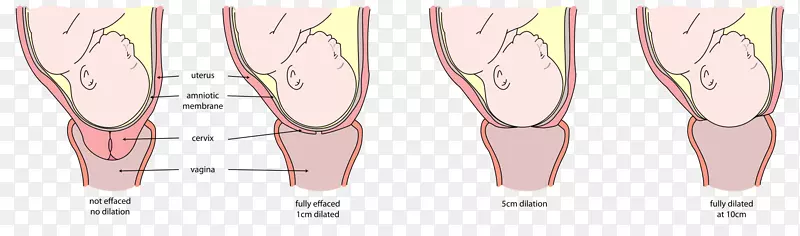 宫颈扩张，宫颈渗出，分娩，妊娠