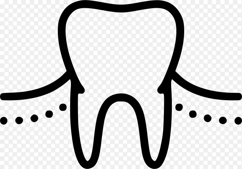 牙科、牙医学、牙龈接合医师-牙医牙龈护罩