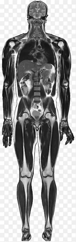 核磁共振成像医学成像解剖人体核磁共振标准体