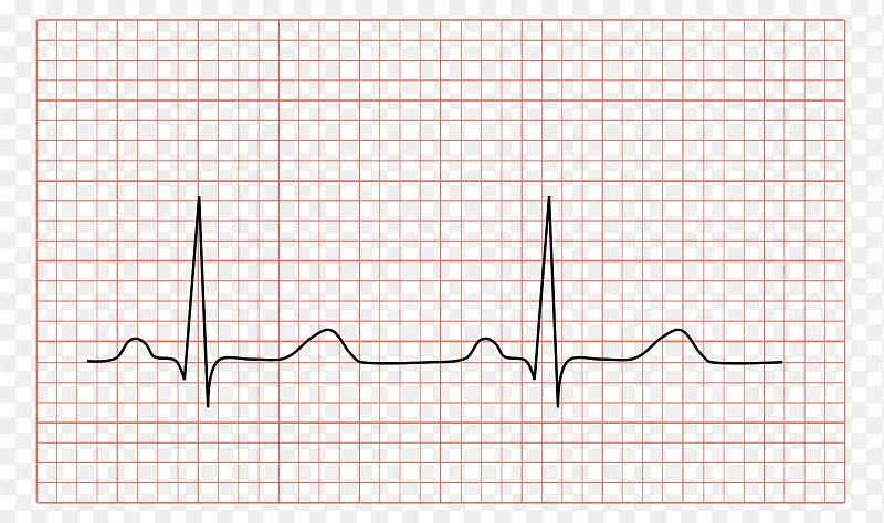 动态心电图窦性心律QRs复合心脏病-心脏