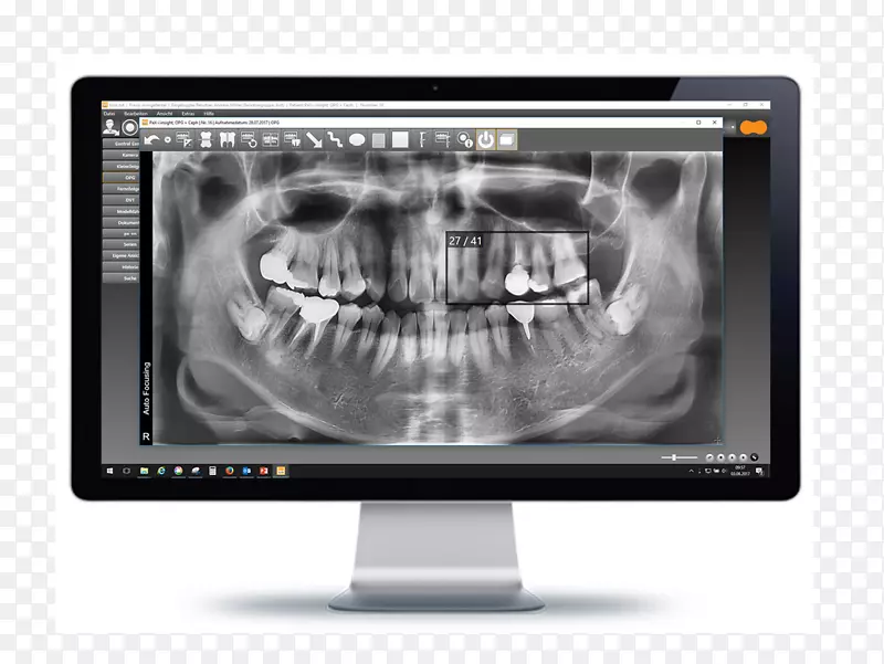 计算机监控医学影像多媒体产品设计-橙色牙医