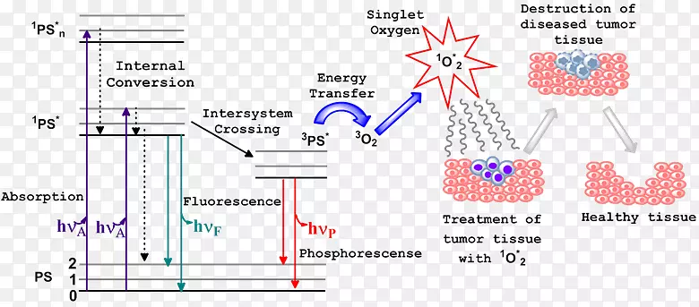光动力疗法单线态氧Jablonski图光敏剂-卡通癌细胞