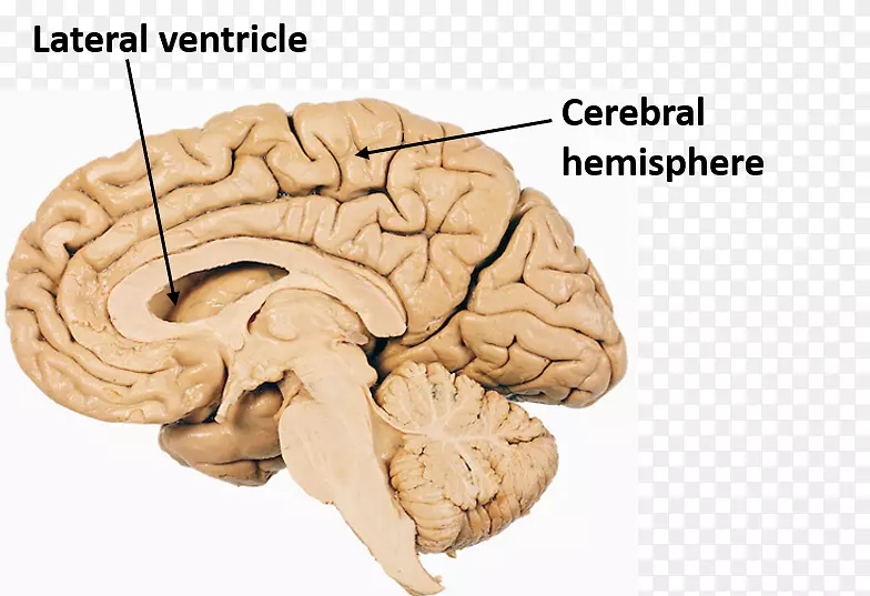 人脑垂体解剖四叉神经体-脑