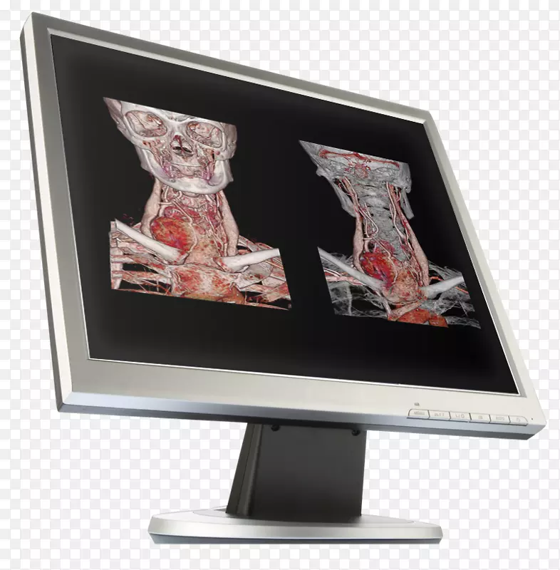 计算机监控工作流图像计算机断层扫描佳能医疗系统公司-SEMAR