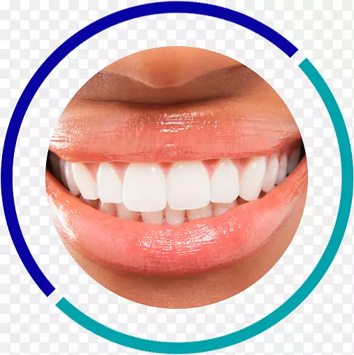 牙齿美白-人类牙齿美容牙科