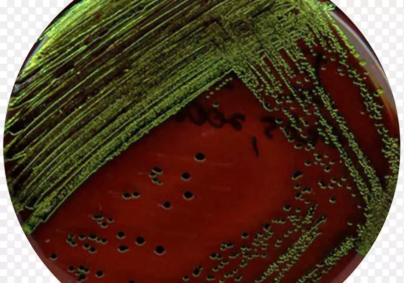 e。大肠杆菌伊红亚甲基蓝琼脂平板大肠杆菌