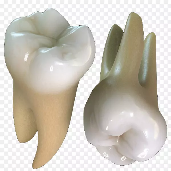 人上颌第一磨牙蛀牙冠