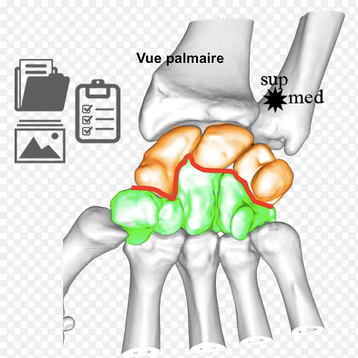 拇指尺神经腕关节解剖