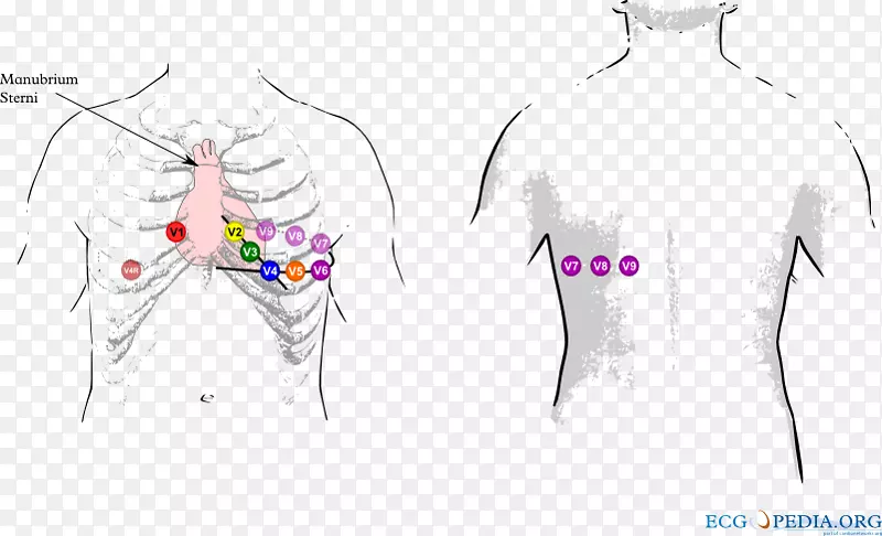 心电图12导联心电图：解释梗死窦性心律的技巧-心电图导联