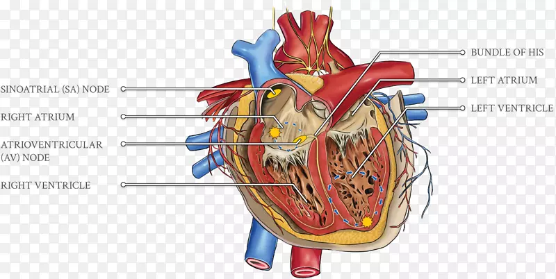 心脏病学，高胆固醇血症，心血管疾病，心脏监测-心电图室性心动过速