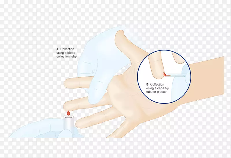 拇指医用手套产品手模型.毛细血管作用