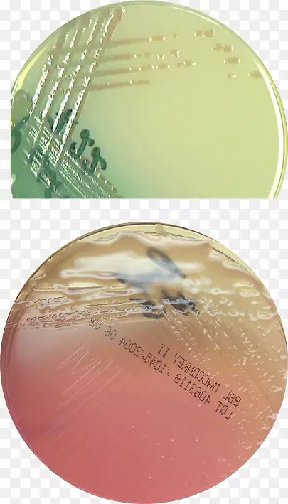 铜绿假单胞菌黄斑部琼脂-假单胞菌烧伤创面