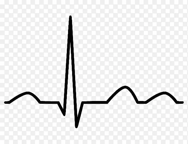 心电描记术心脏病学心脏窦性心律-心电图
