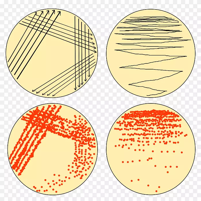 麦角琼脂上的条状微生物培养菌-耶尔森菌(Yersinia)
