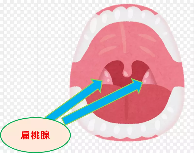 口腔扁桃体咽喉治疗-消化