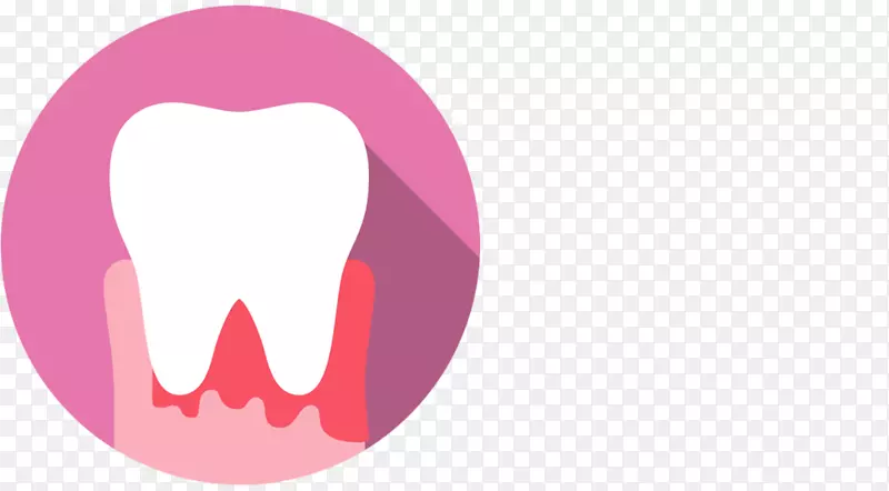 人类牙龈-牙科急症
