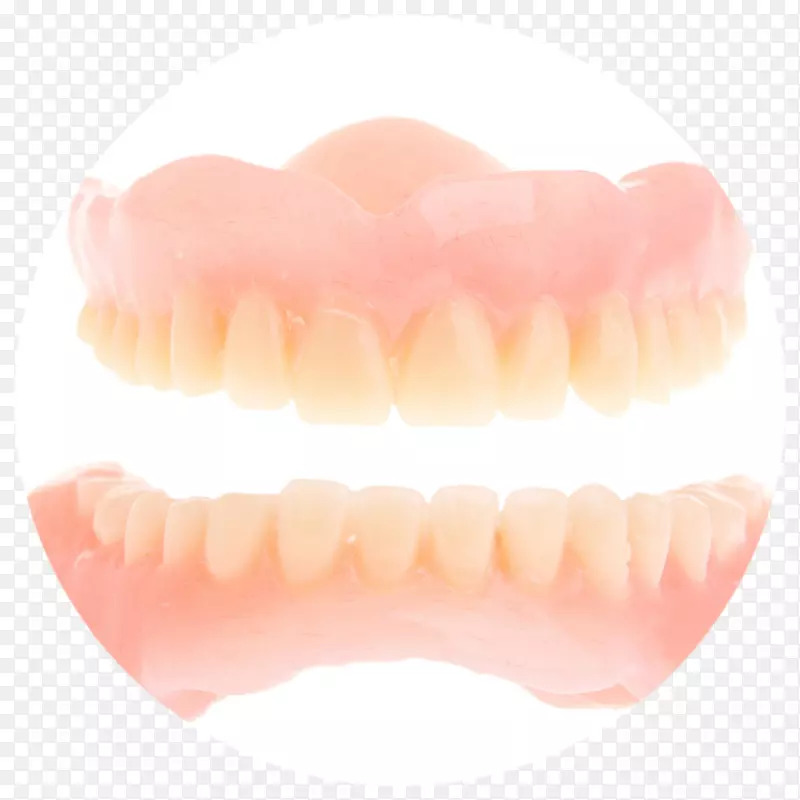 人牙义齿.美容牙科植入物