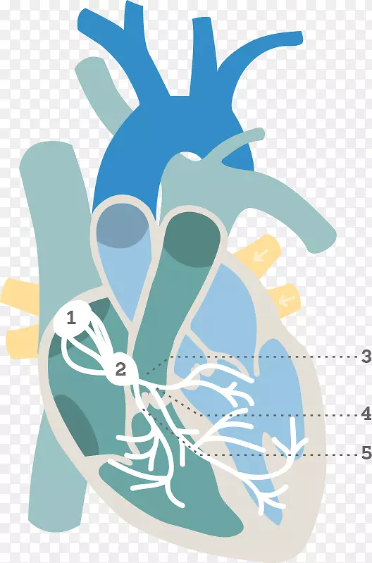 心室心房-心脏心电图传导系统
