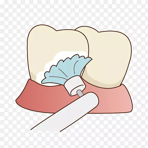 蛀牙清洁牙周病牙医-牙科