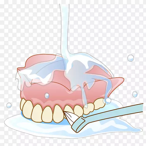 牙齿义齿牙科治疗可摘局部义齿
