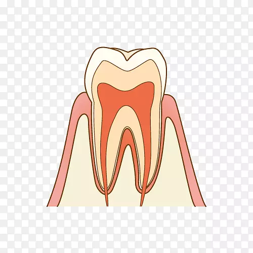 牙科龋齿治疗根管治疗牙线