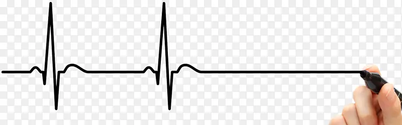 心电图 心脏 心率