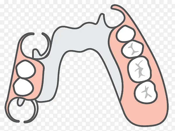 可摘局部义齿 假牙 牙种植
