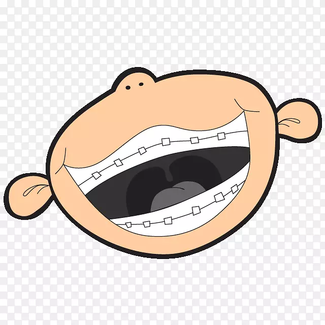 卡通男孩张大嘴巴矫正牙齿插画免